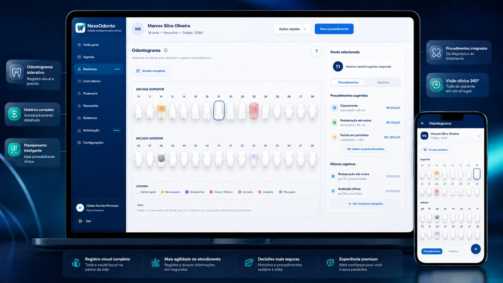 Odontograma digital demonstrativo do NexoOdonto com paciente e procedimentos fictícios